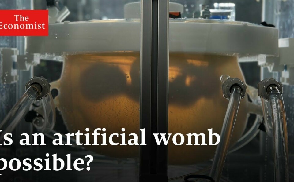 Are artificial wombs the future?